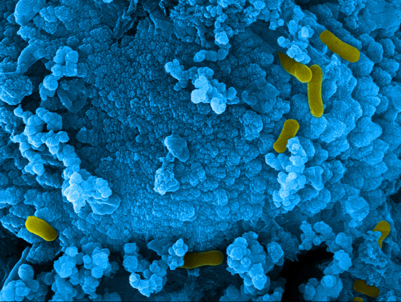 Microbes and Materials