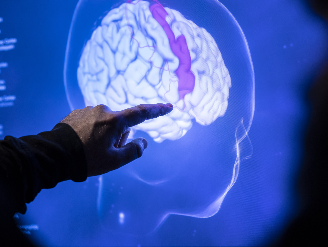 Someone's finger points at a brain on a screen