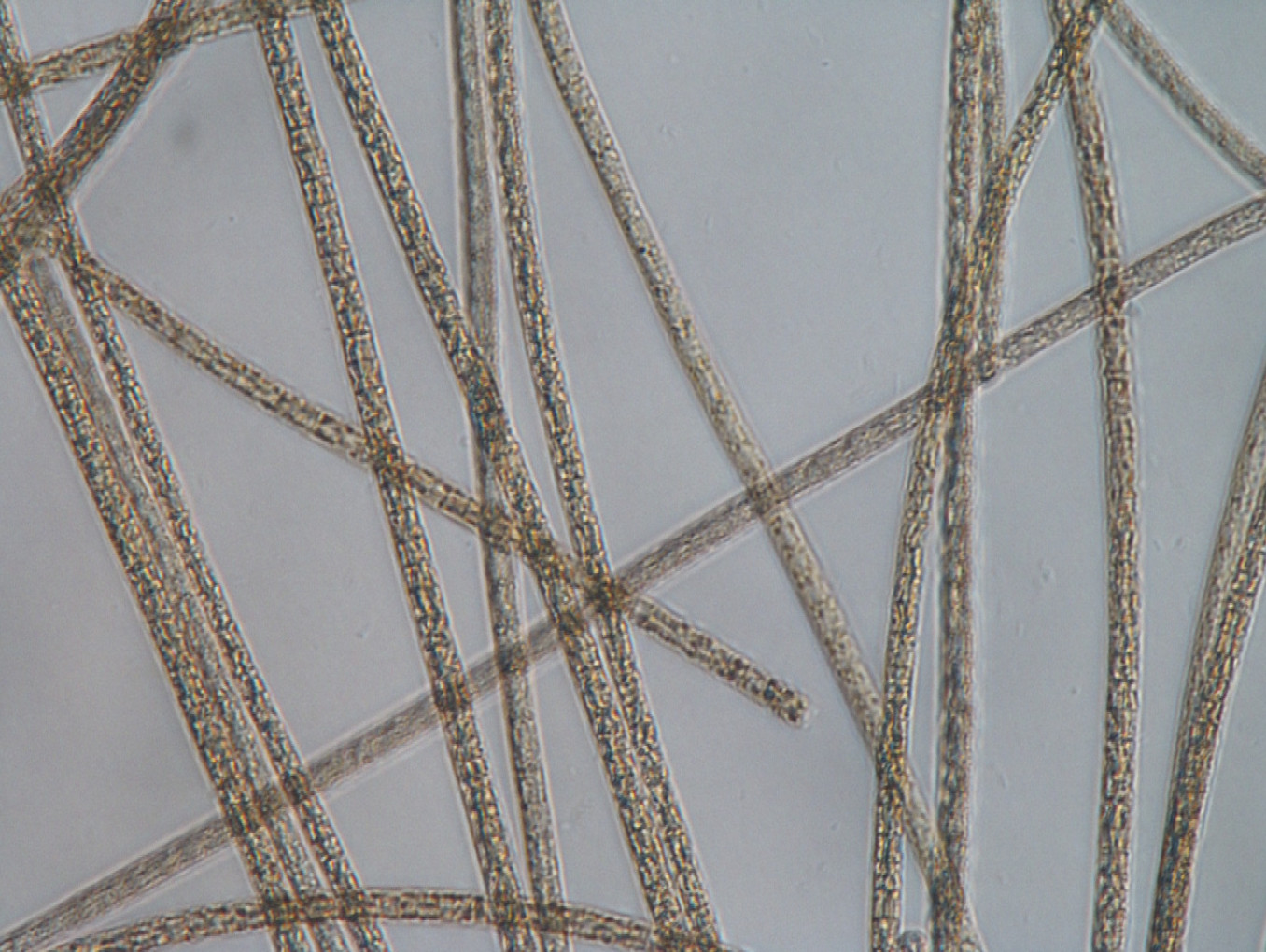 Wastewater under the microscope