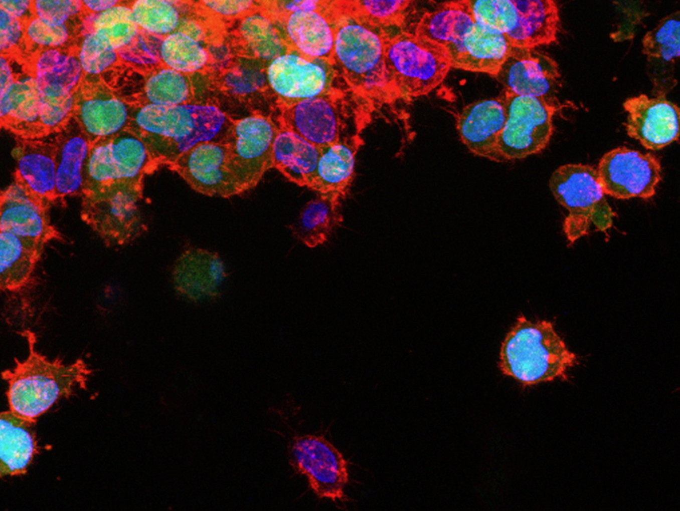 Cancer cells under the microscope