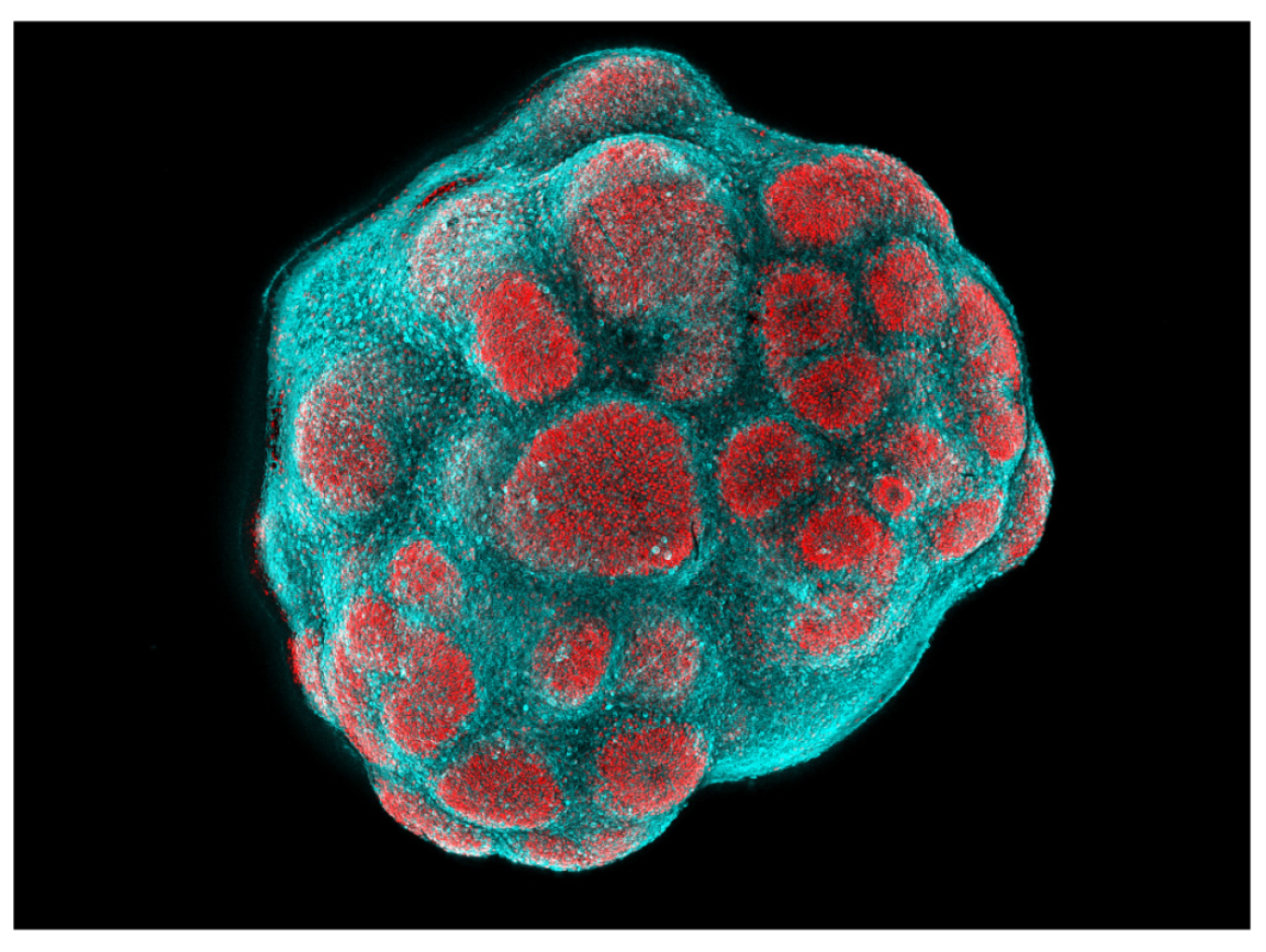 stem cells