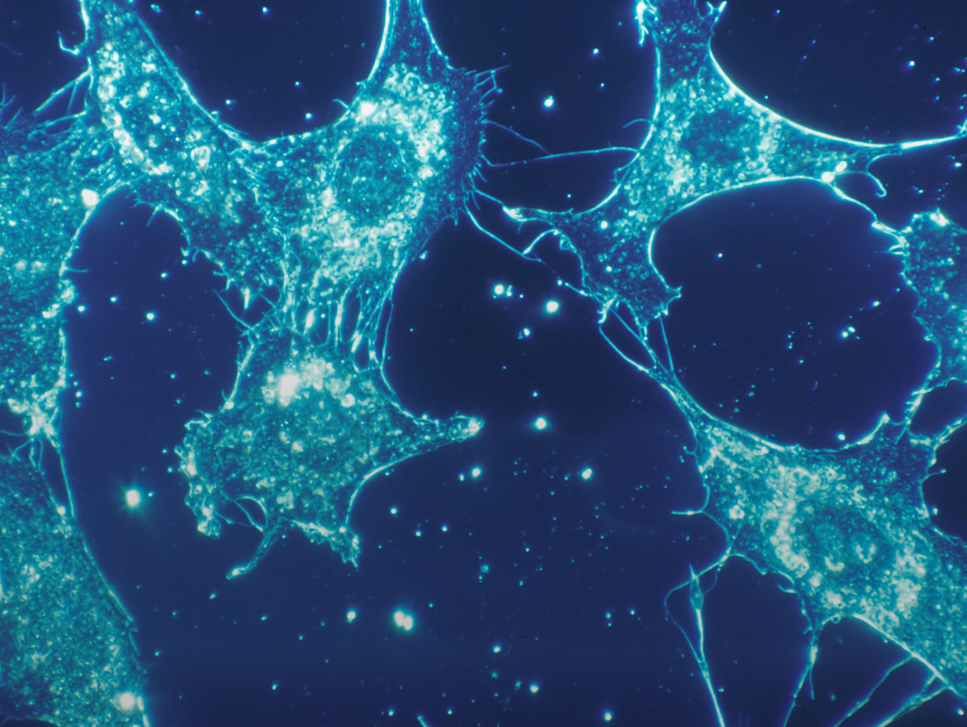 Normal cells of human connective tissue in culture at a magnification of 500x