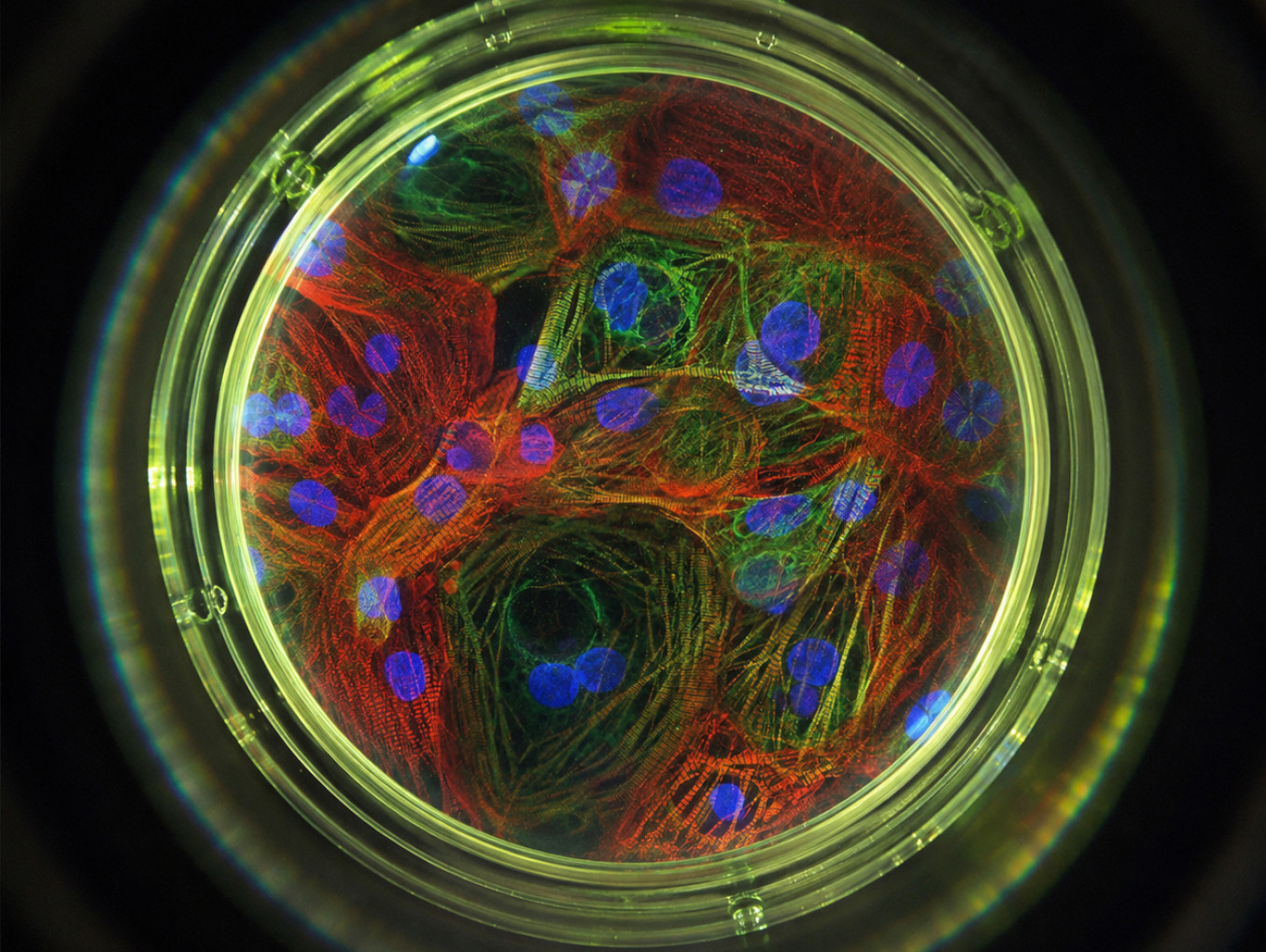 Microscopy image of iPSC-derived Cardiomyocytes