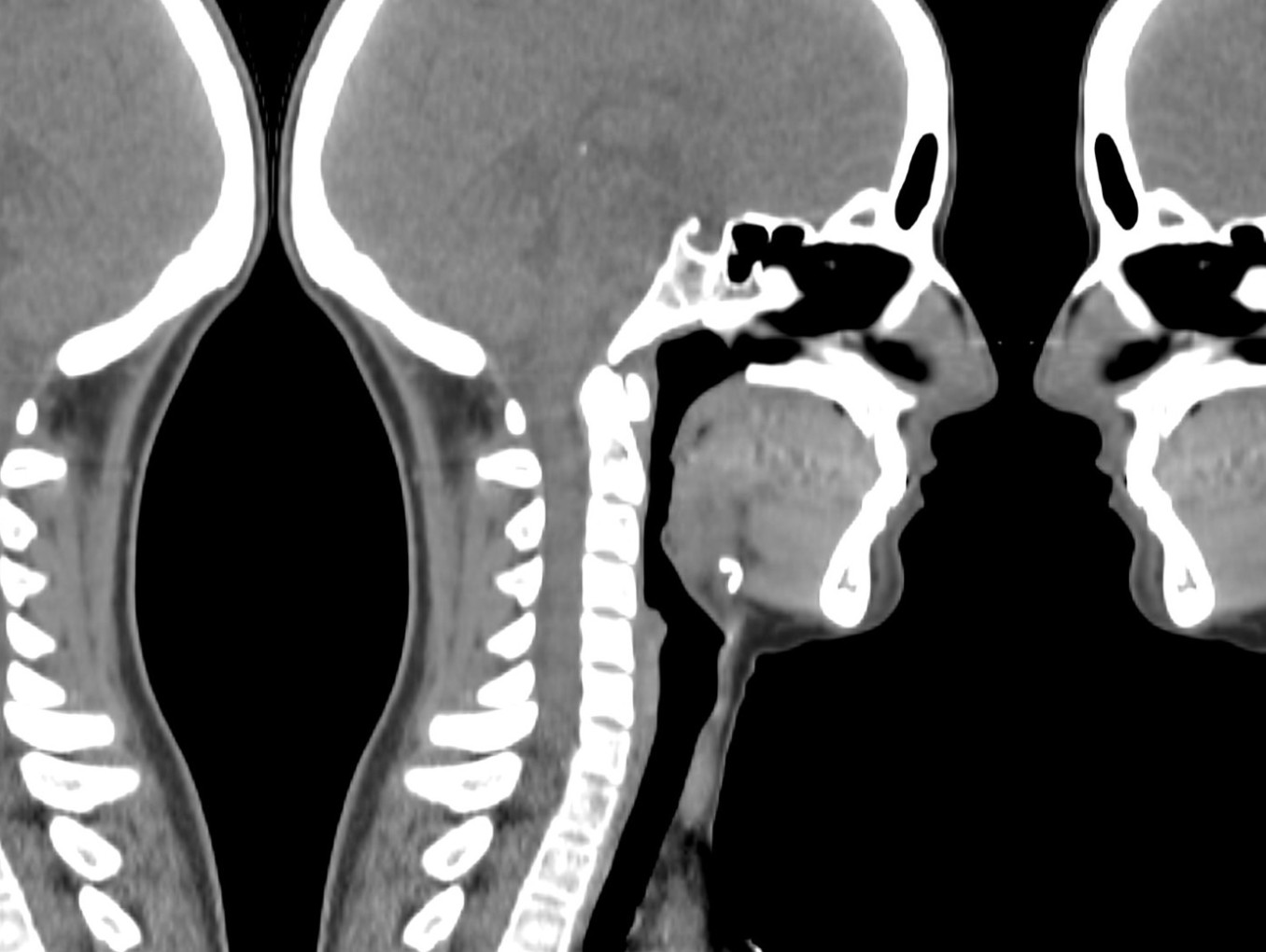 Three side-view CT scans of the head and neck arranged as a triptych, with the central image engaging one profile while turning away from the other