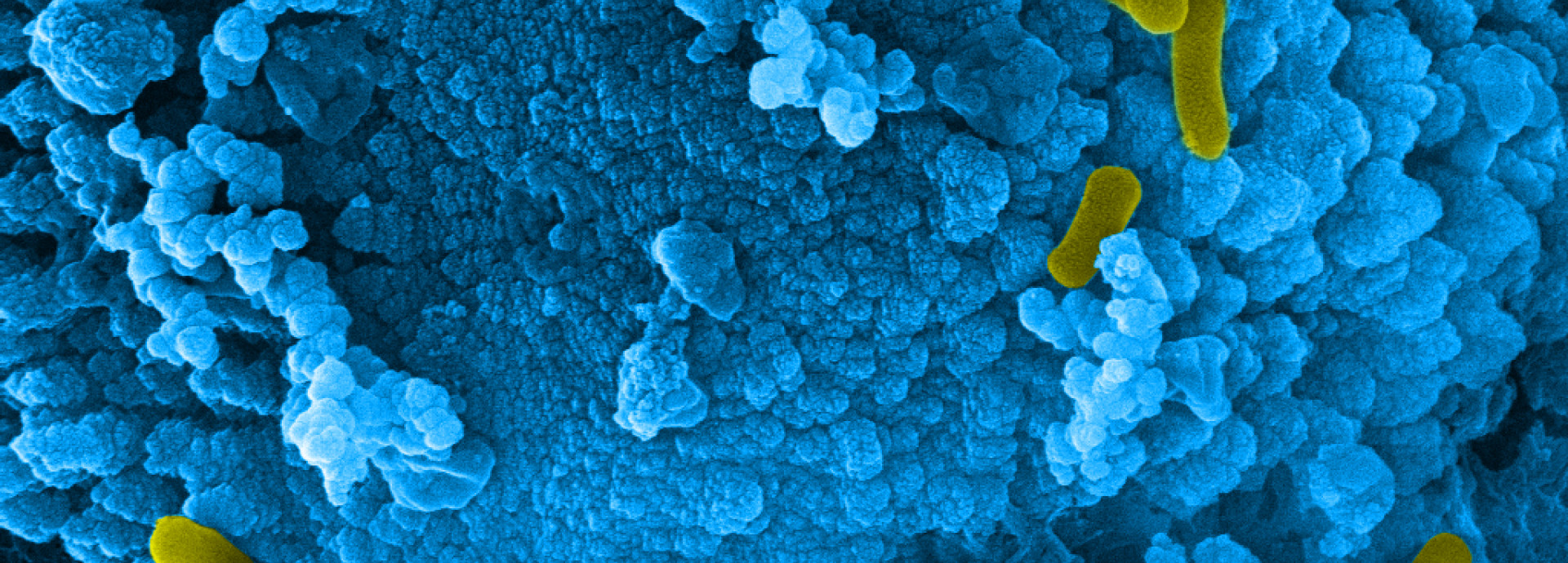 Microbes and Materials