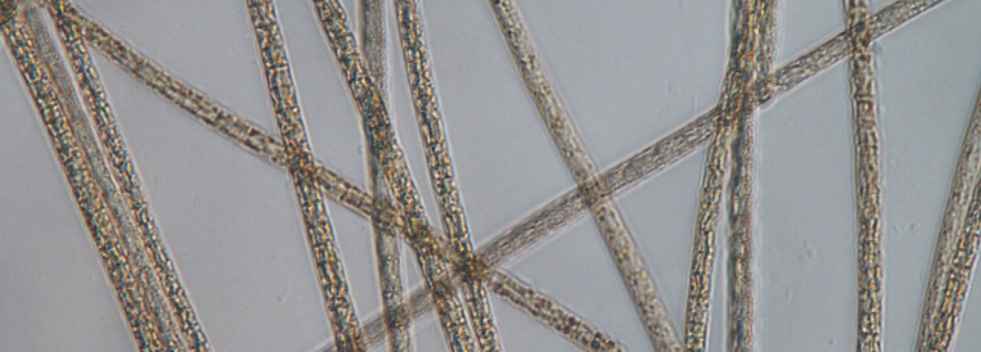 Wastewater under the microscope