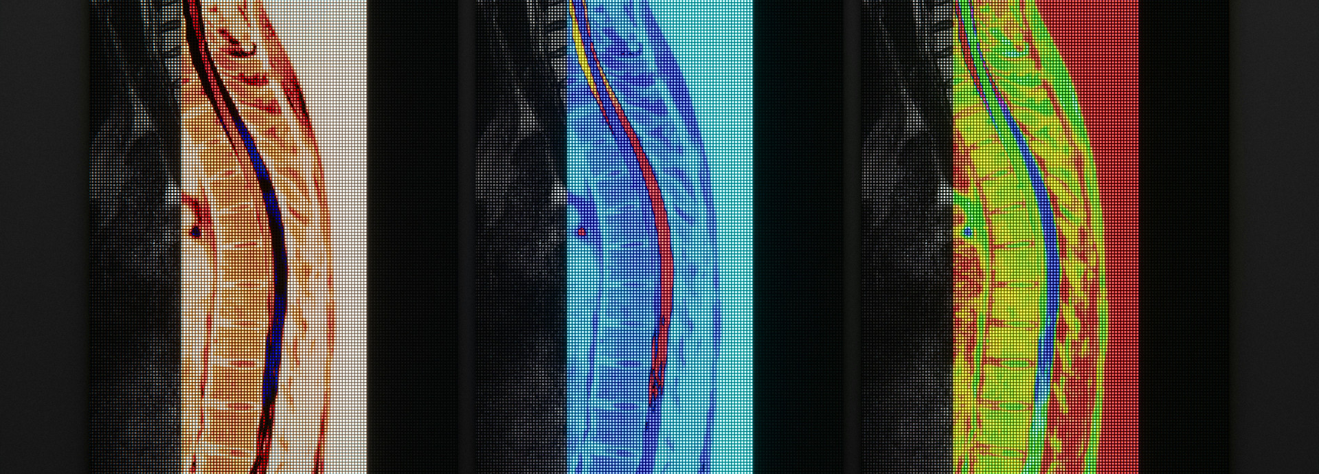Three MRI scans of a human spine with overlaid PET scans.