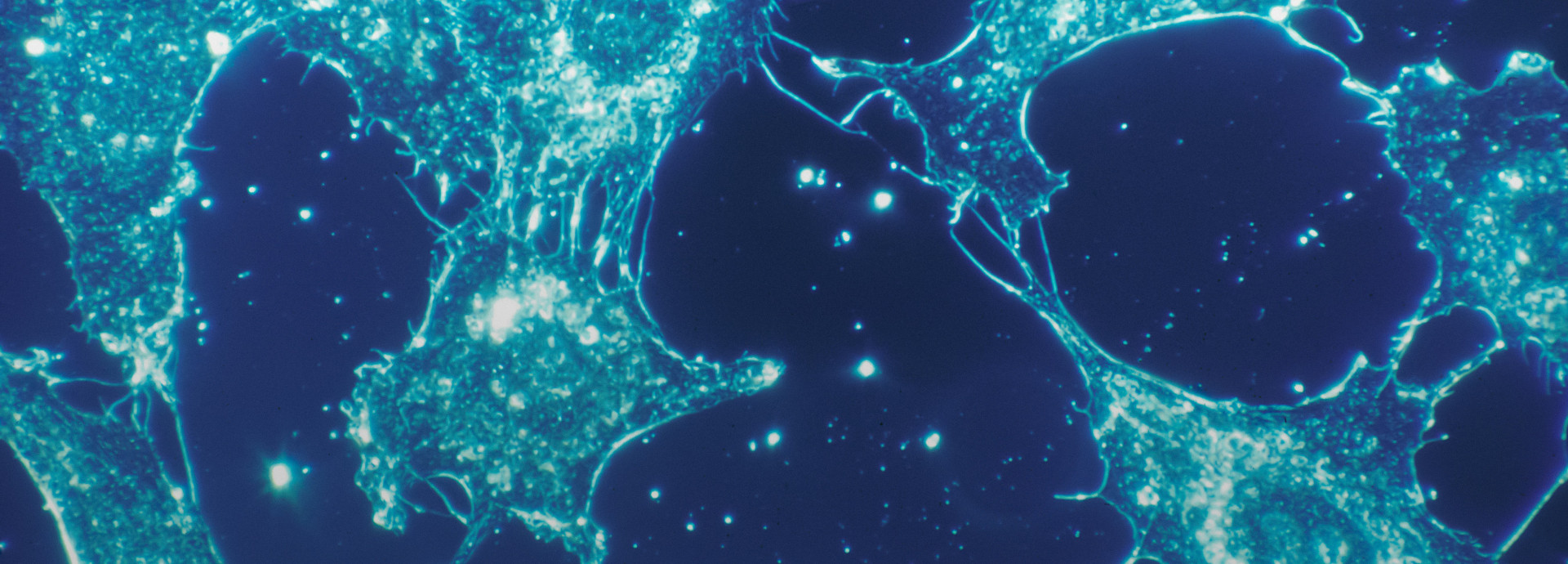 Normal cells of human connective tissue in culture at a magnification of 500x