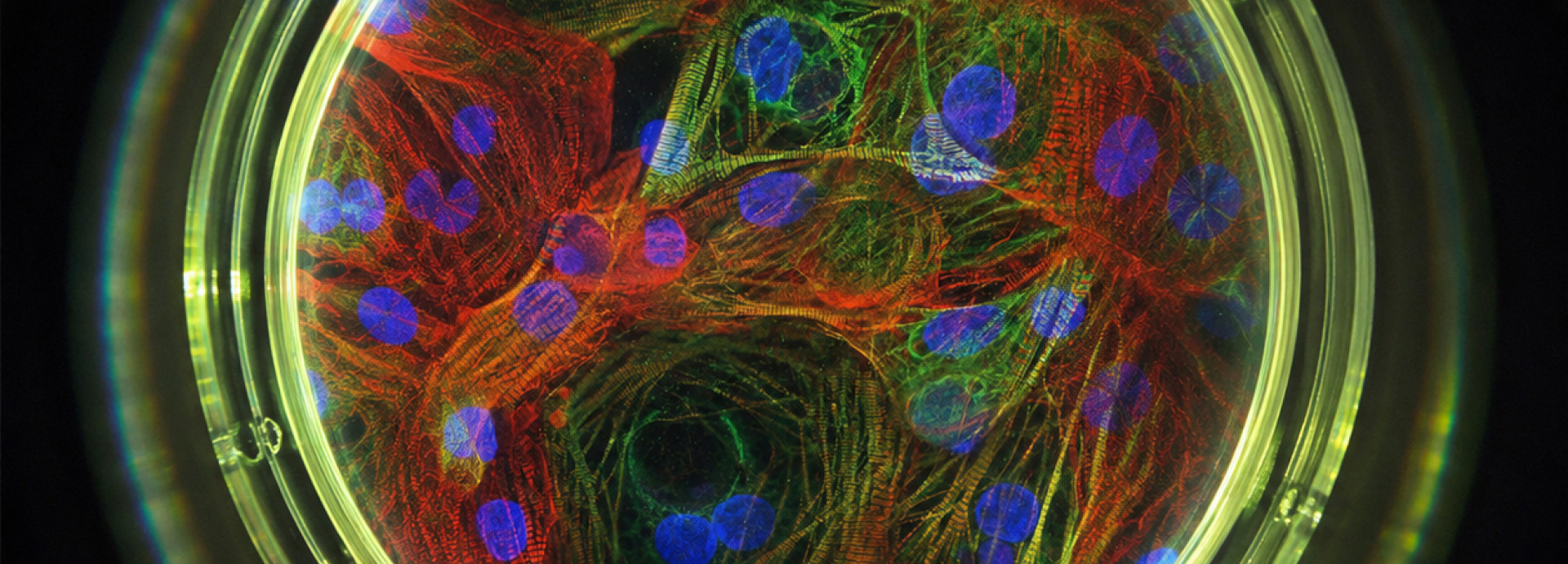 Microscopy image of iPSC-derived Cardiomyocytes