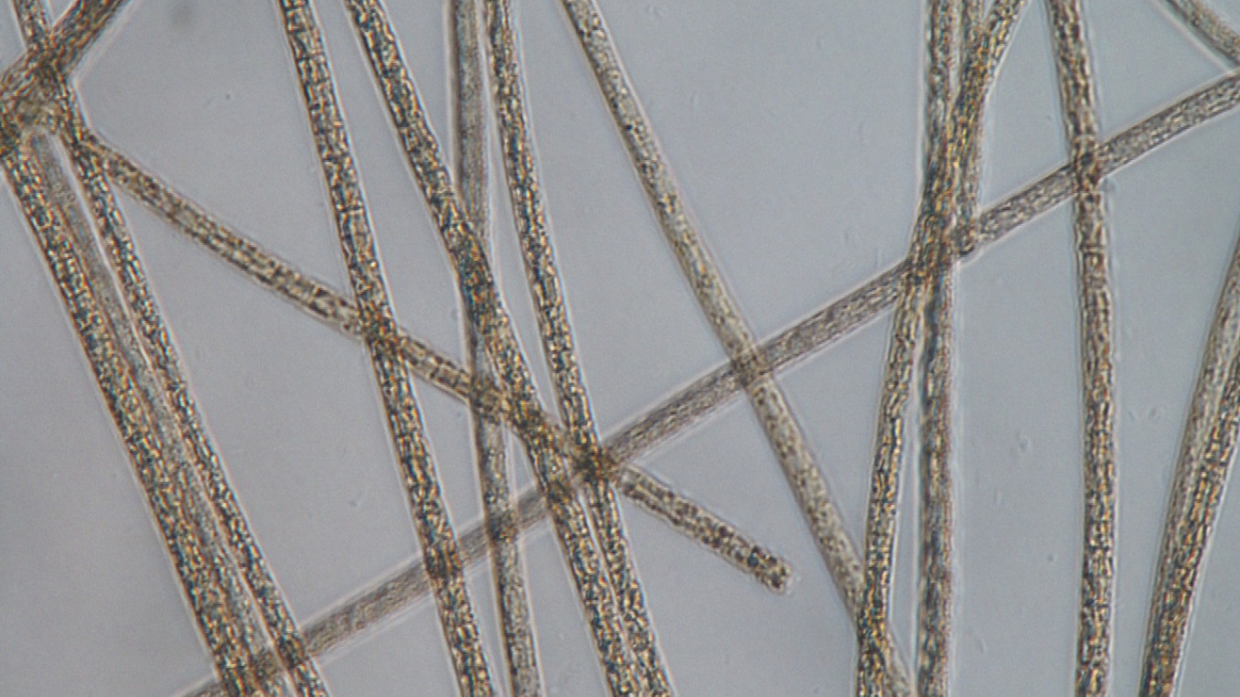 Wastewater under the microscope