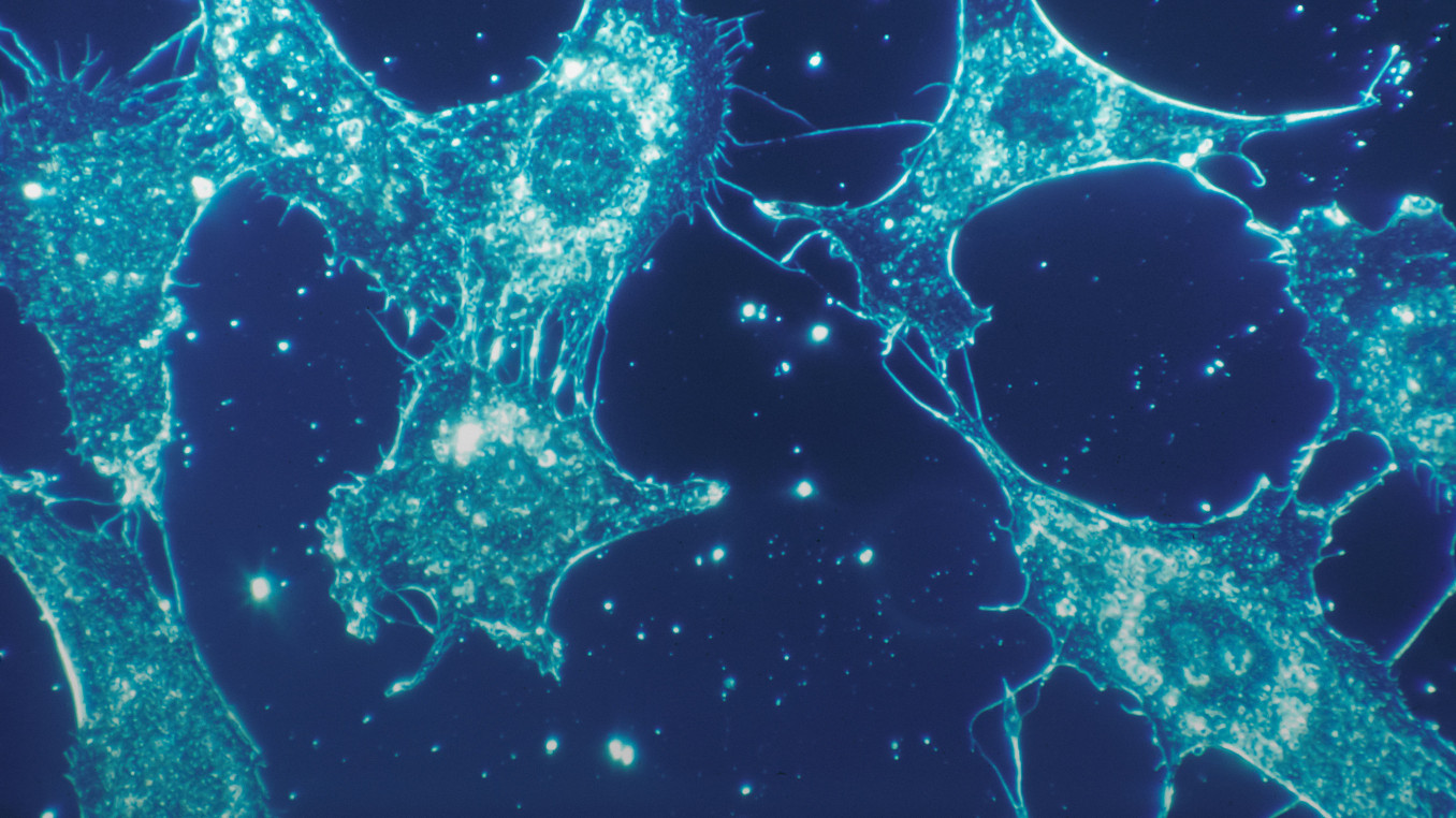 Normal cells of human connective tissue in culture at a magnification of 500x