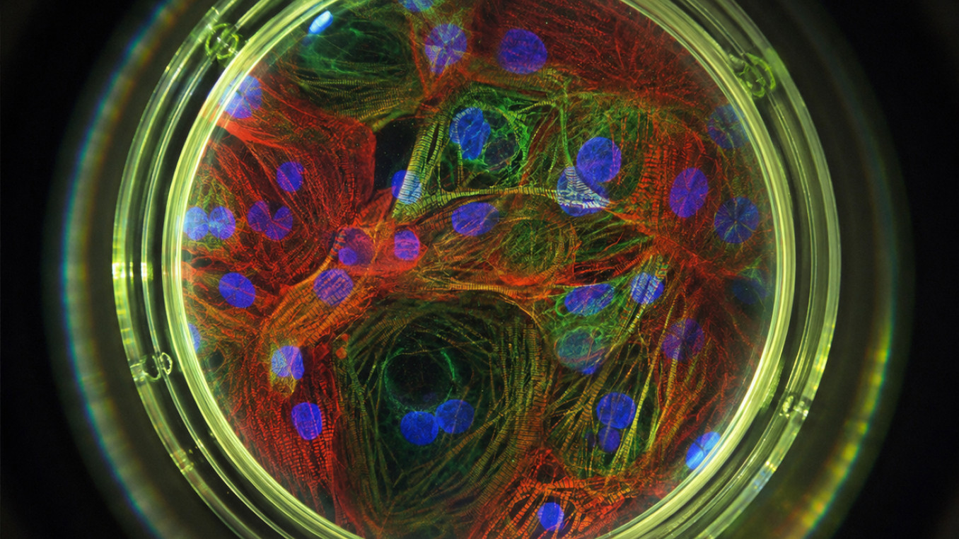 Microscopy image of iPSC-derived Cardiomyocytes